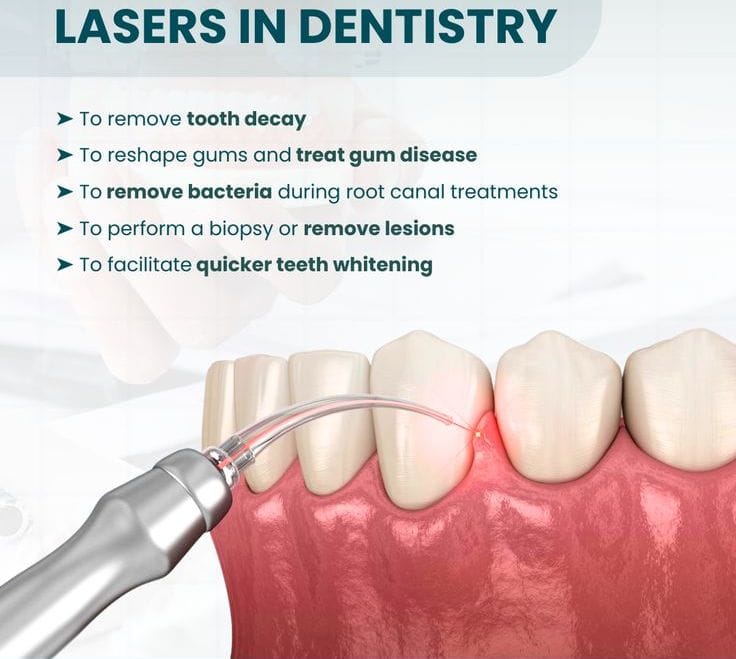 Dental Soft Tissue Diode Laser