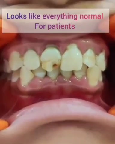 Smart Plaque Detector